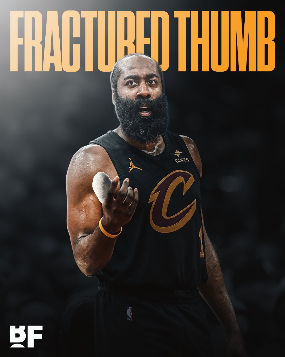 哈登右手拇指骨折，目前正在接受进一步评估。NBA