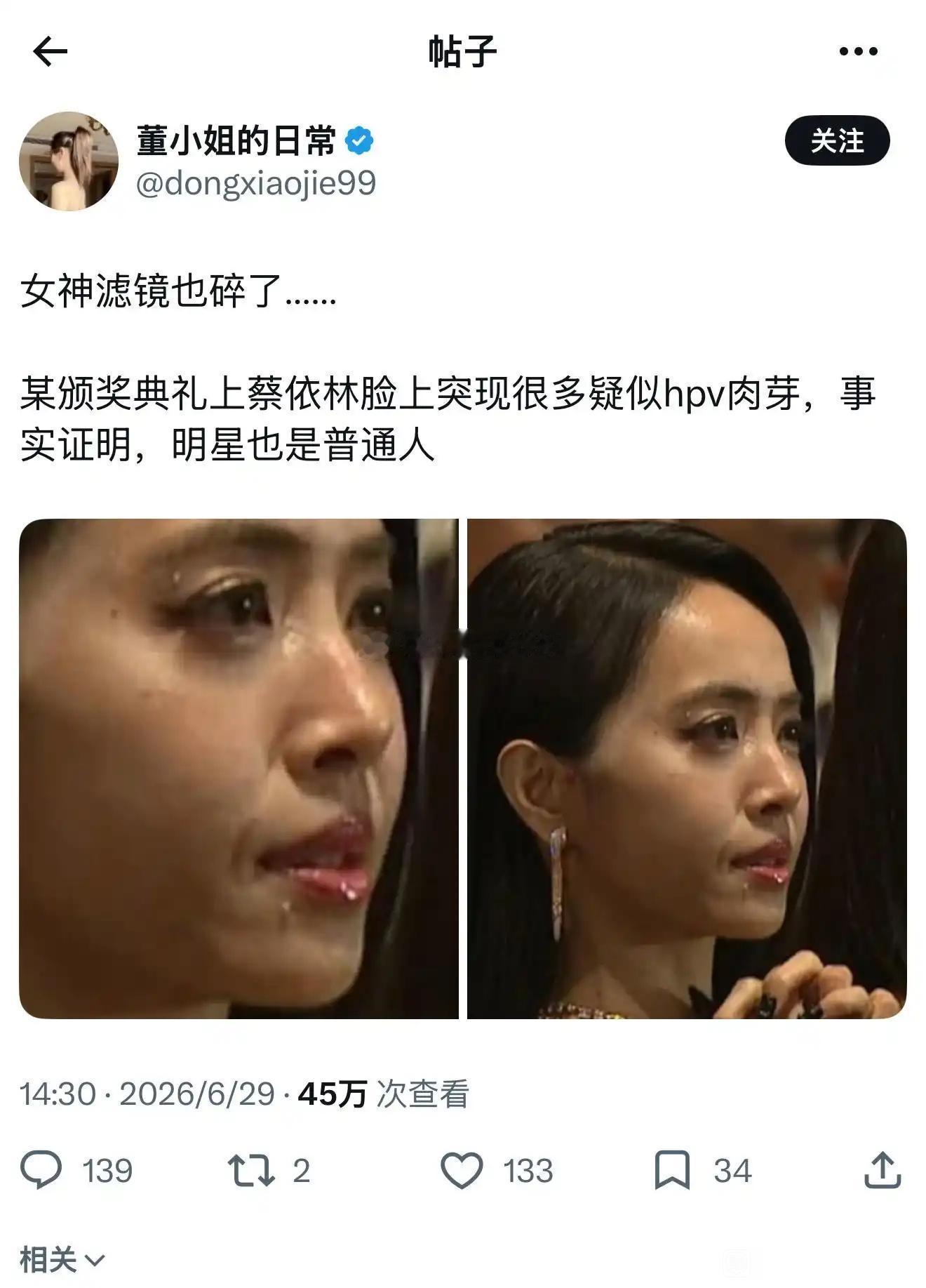 看着好恐怖，怎么没疣事呢 ​​​