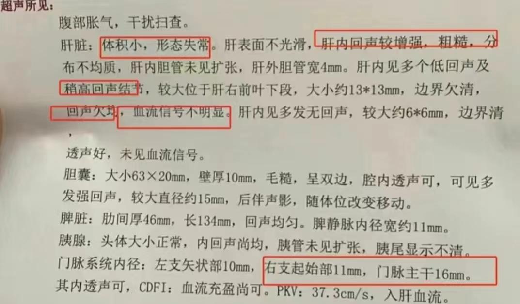 肝脏彩超出现这5项异常，提示肝硬化了！ 1.肝脏形态失常：肝硬化的肝脏...