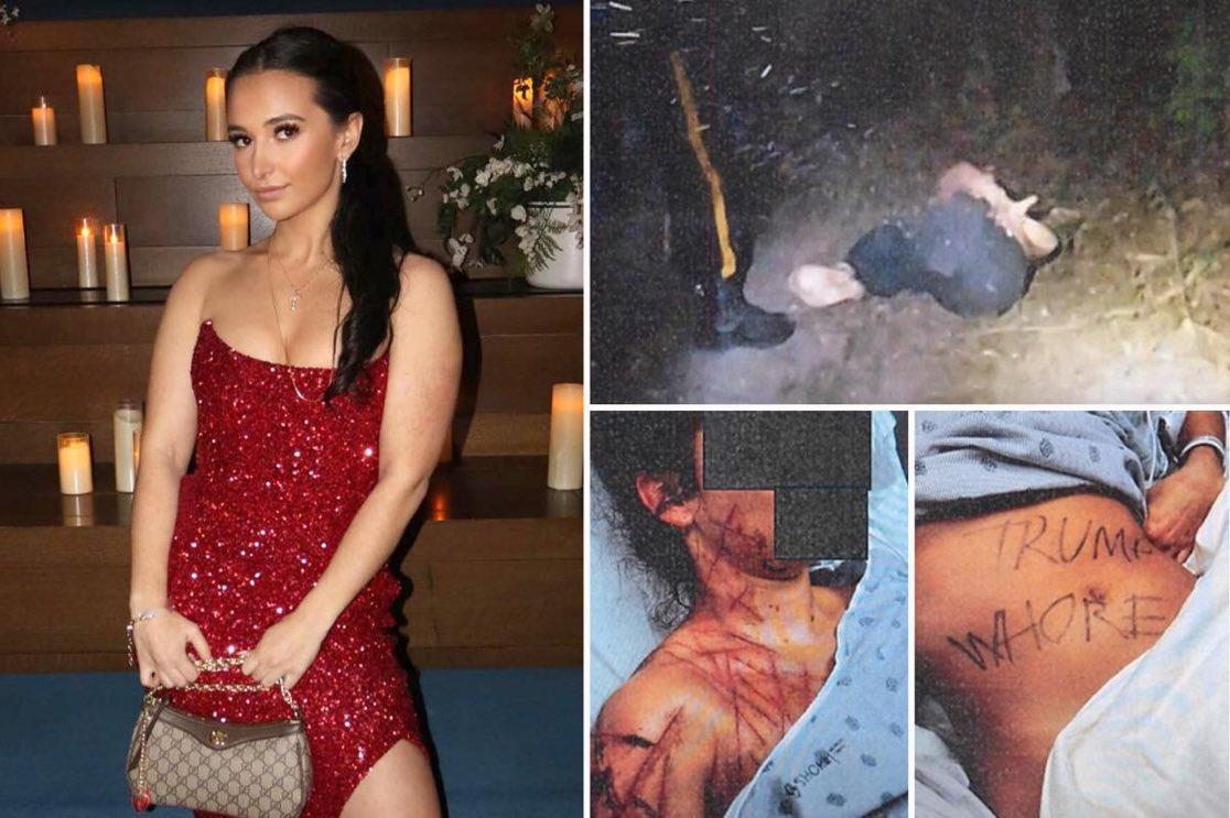 🔻据称前共和党助理付费给恋物癖艺术家对其施虐，并捆绑于树林中，谎称此为反特朗普