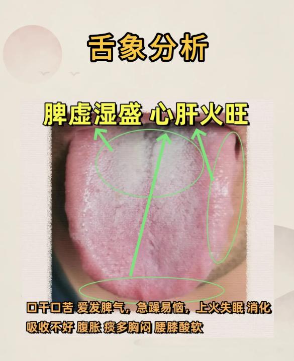舌诊辨证案例：3 例脏腑失调解析