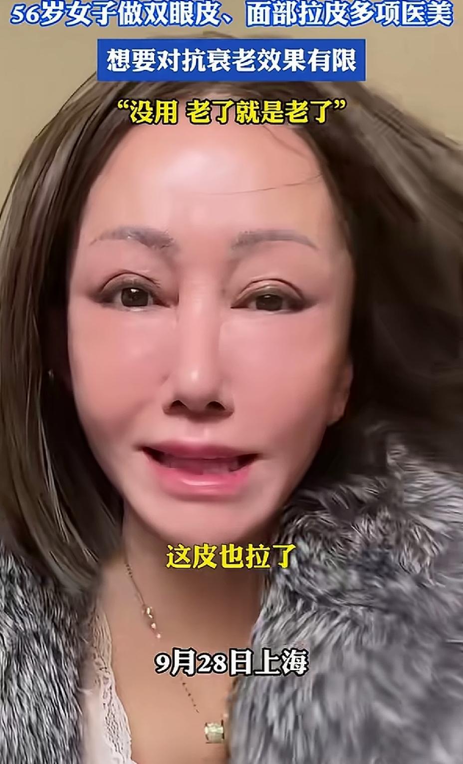 56岁女子，为了变年轻漂亮，割了双眼皮，又是拉皮，做眼袋，仍然感叹，还是又老又丑