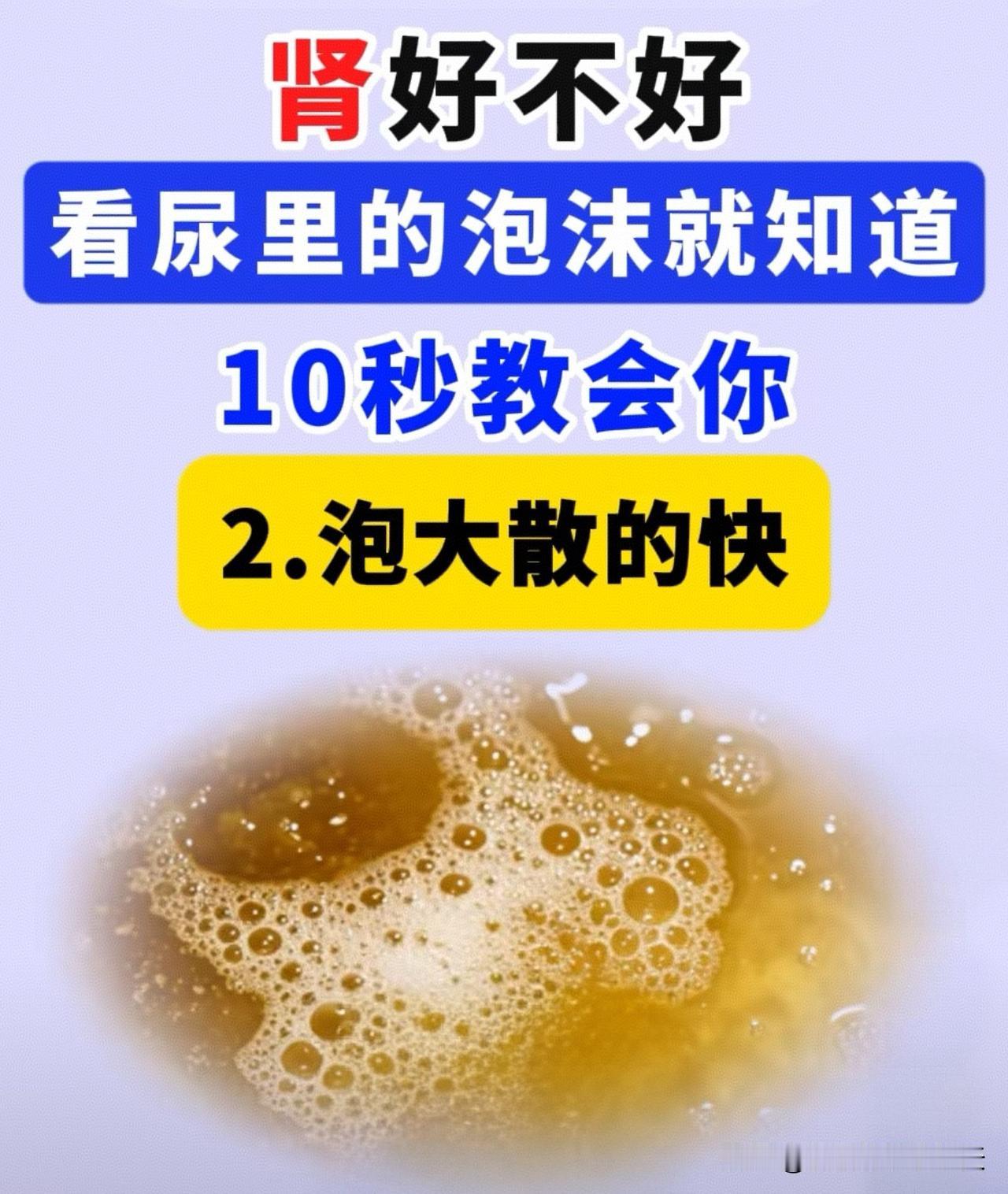 尿液上有泡沫，你害怕了吗？居家简单自测，分清肾脏预警泡沫和普通泡沫
      