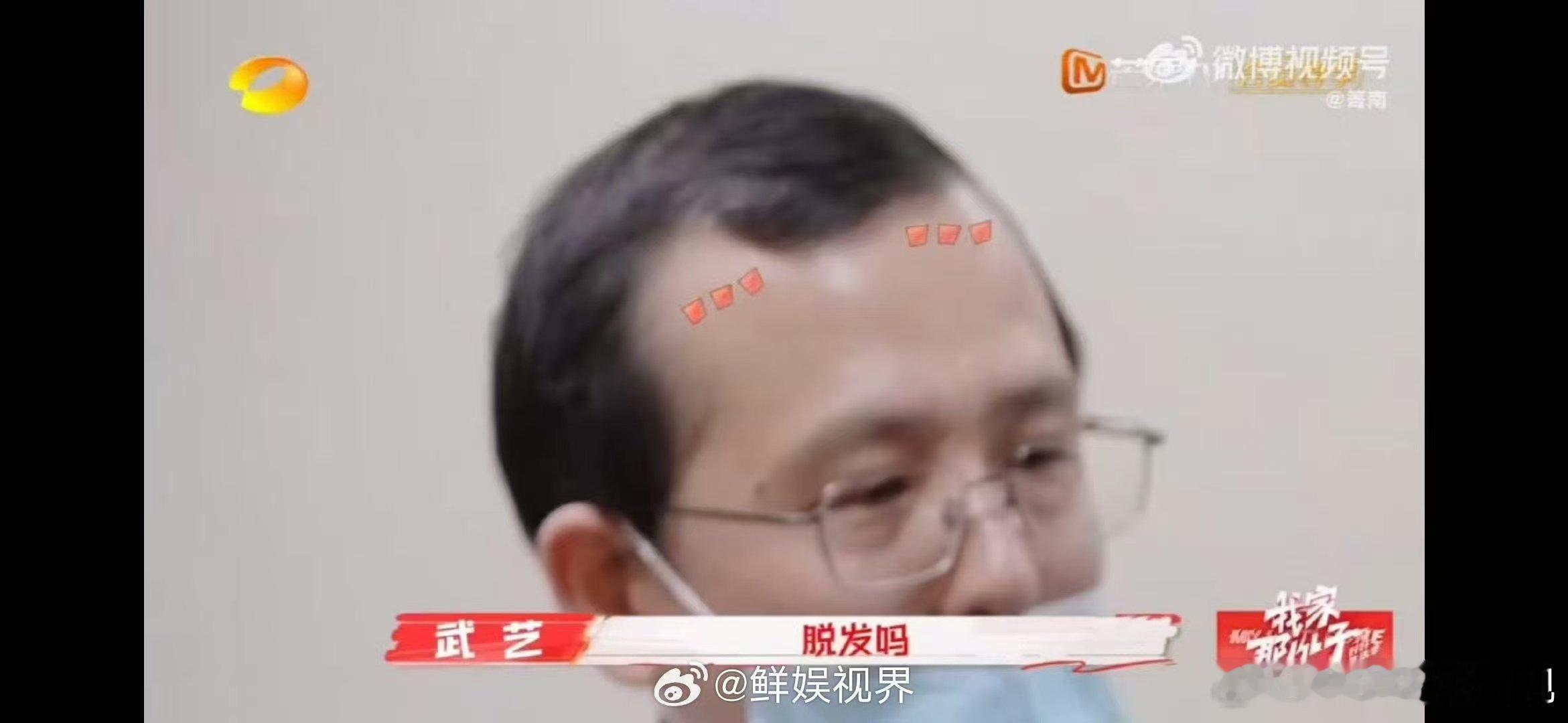 武艺问正骨医生能治脱发吗  武艺的脑回路永远让人意想不到，正骨时刻还惦记着脱发，
