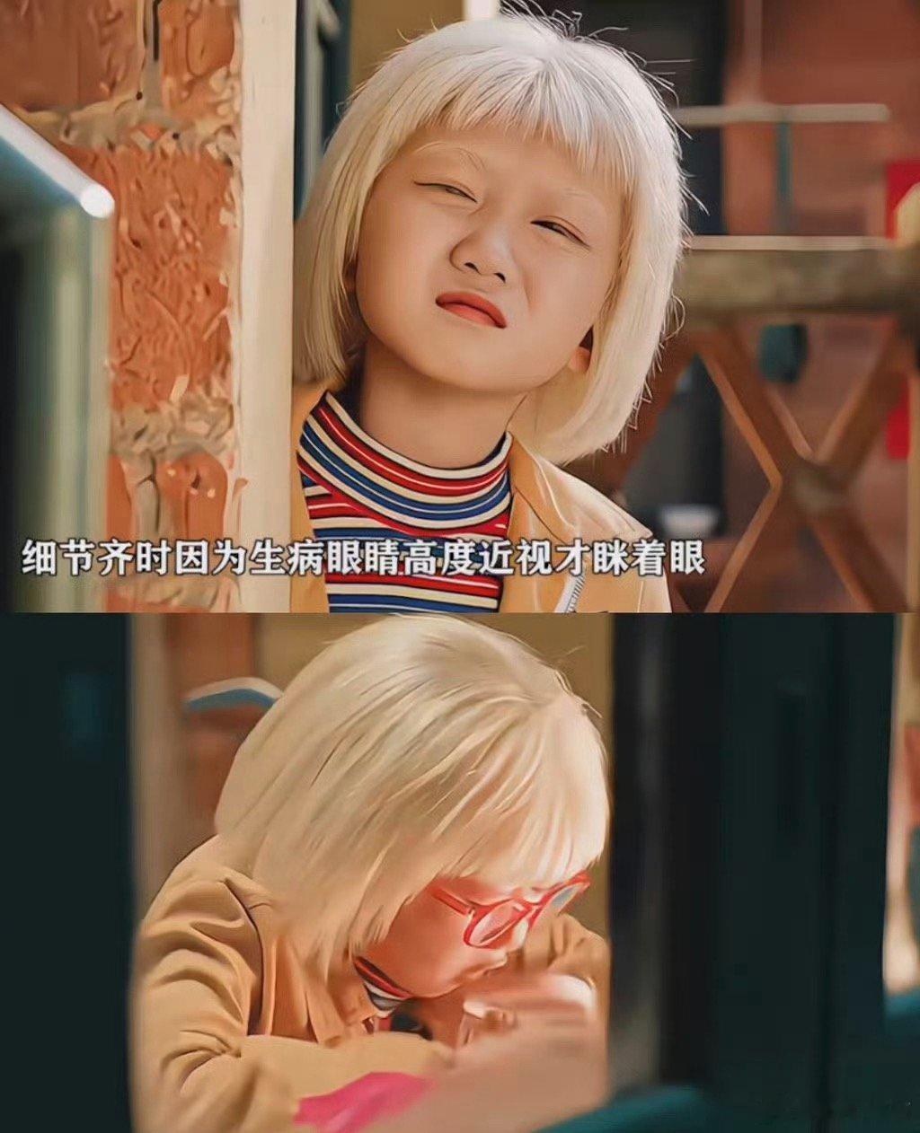 关晓彤演白化病人眼球轻颤刚刷到，这是什么剧？关晓彤演的好好啊……我特别喜欢这种聚