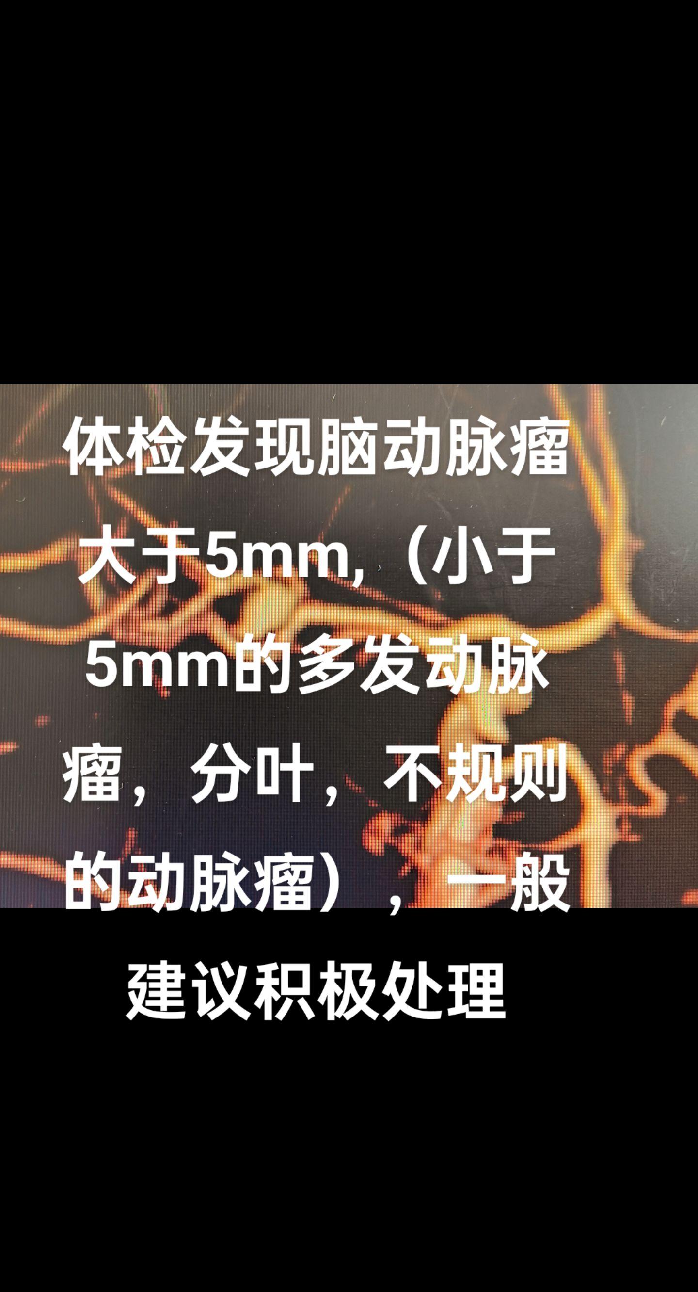 医务人员的日常 血管 医生日常