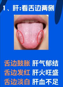 舌诊不传之秘在于四个字——独处藏奸

“独处藏奸”简单来说就是要从细微之处勘察病