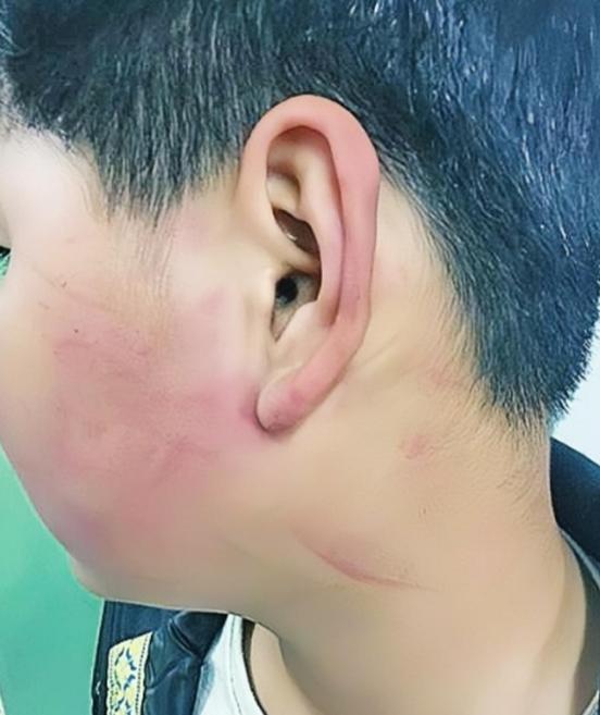 2019年，四川一名校长，因学生调皮，扇了他几巴掌，被孩子母亲逼着赔礼道歉。不料