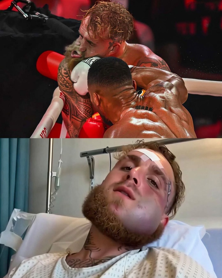 被前拳王打断下巴网红拳手：我和约书亚各赢2回合输在备战不足