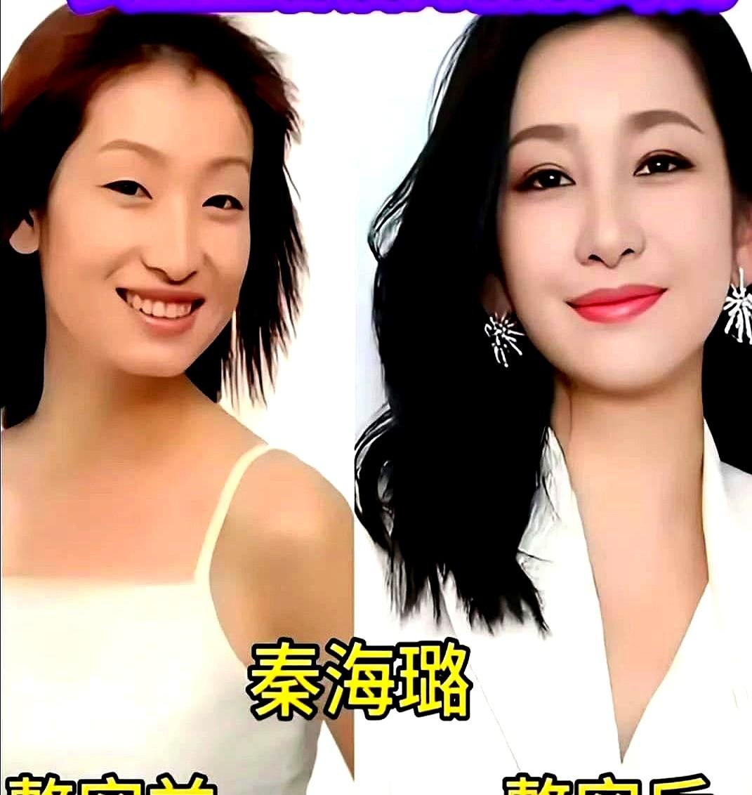 刷到一组女星今昔对比图，还真是挺感慨的。
秦海璐丢掉当年那张方脸，藏起小眼睛，直