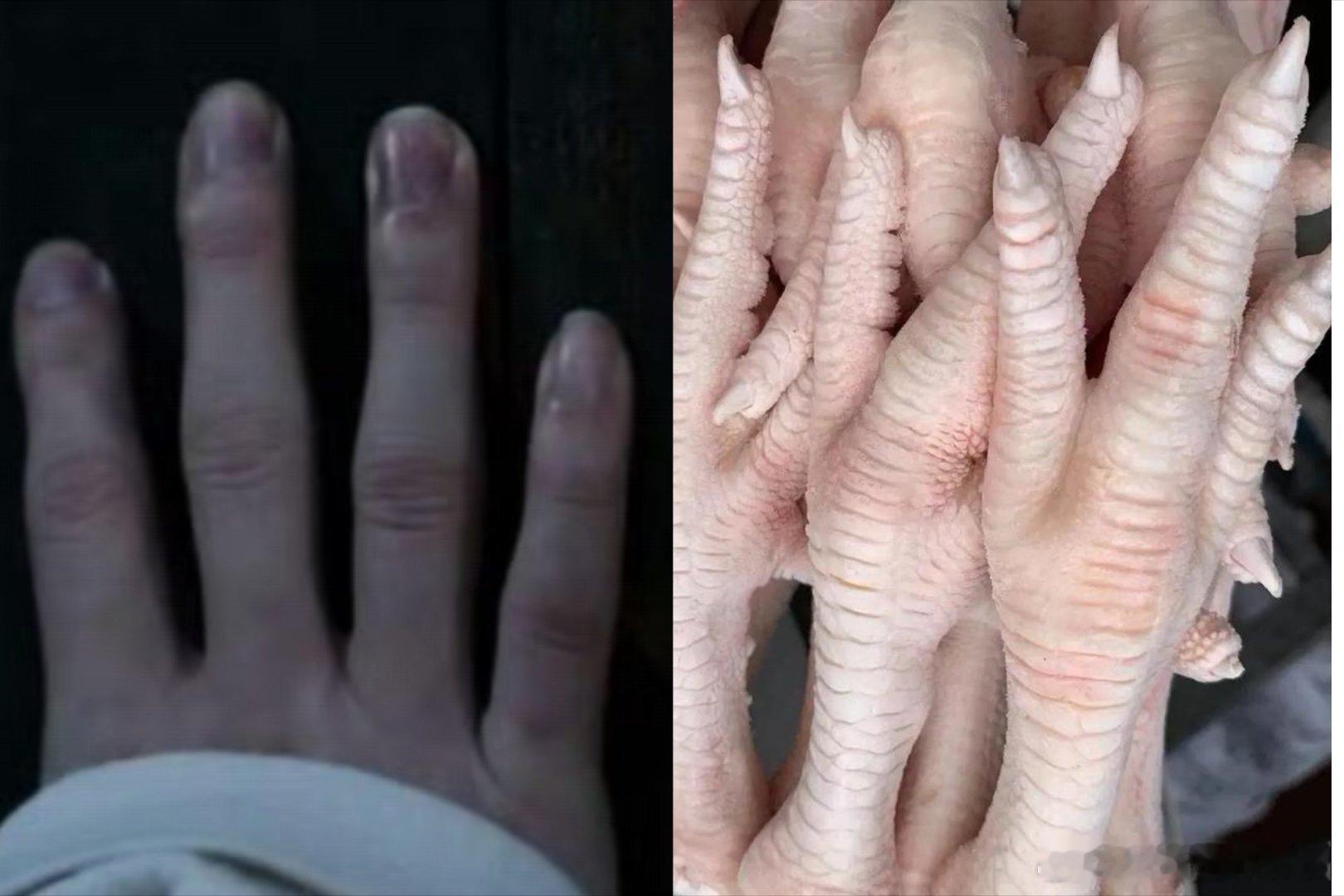 315，双氧水凤爪上榜了，大家还是自己家里做了吃吧，别买外面的。 