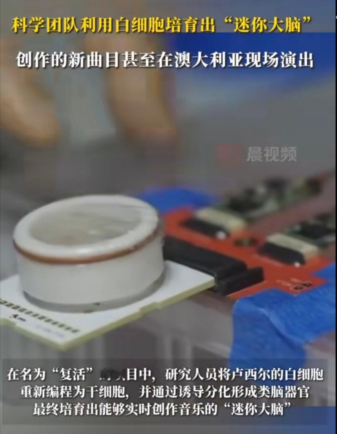 作曲家去世四年后大脑还能编曲这个科研项目太厉害了，只需要留有艺术家的细胞样本 ​