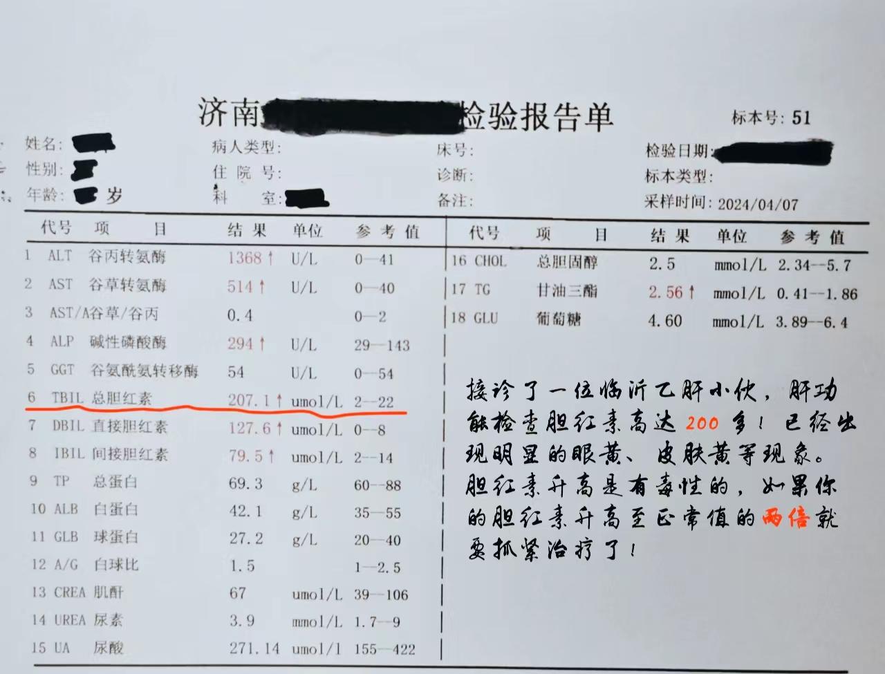 山东 乙肝 图文来了