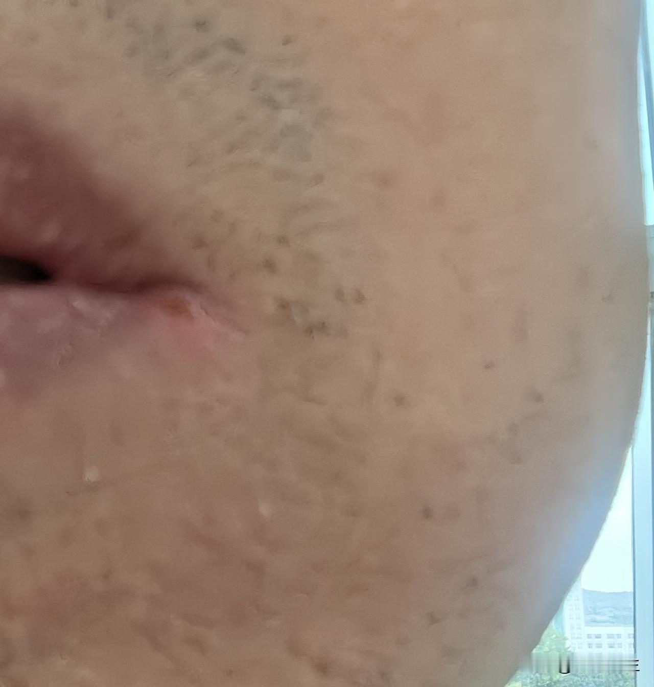 自己炒的蒲公英茶最近真的是派上了大用场，上周一嘴角出了一个火疖子，感觉疼痛的，心