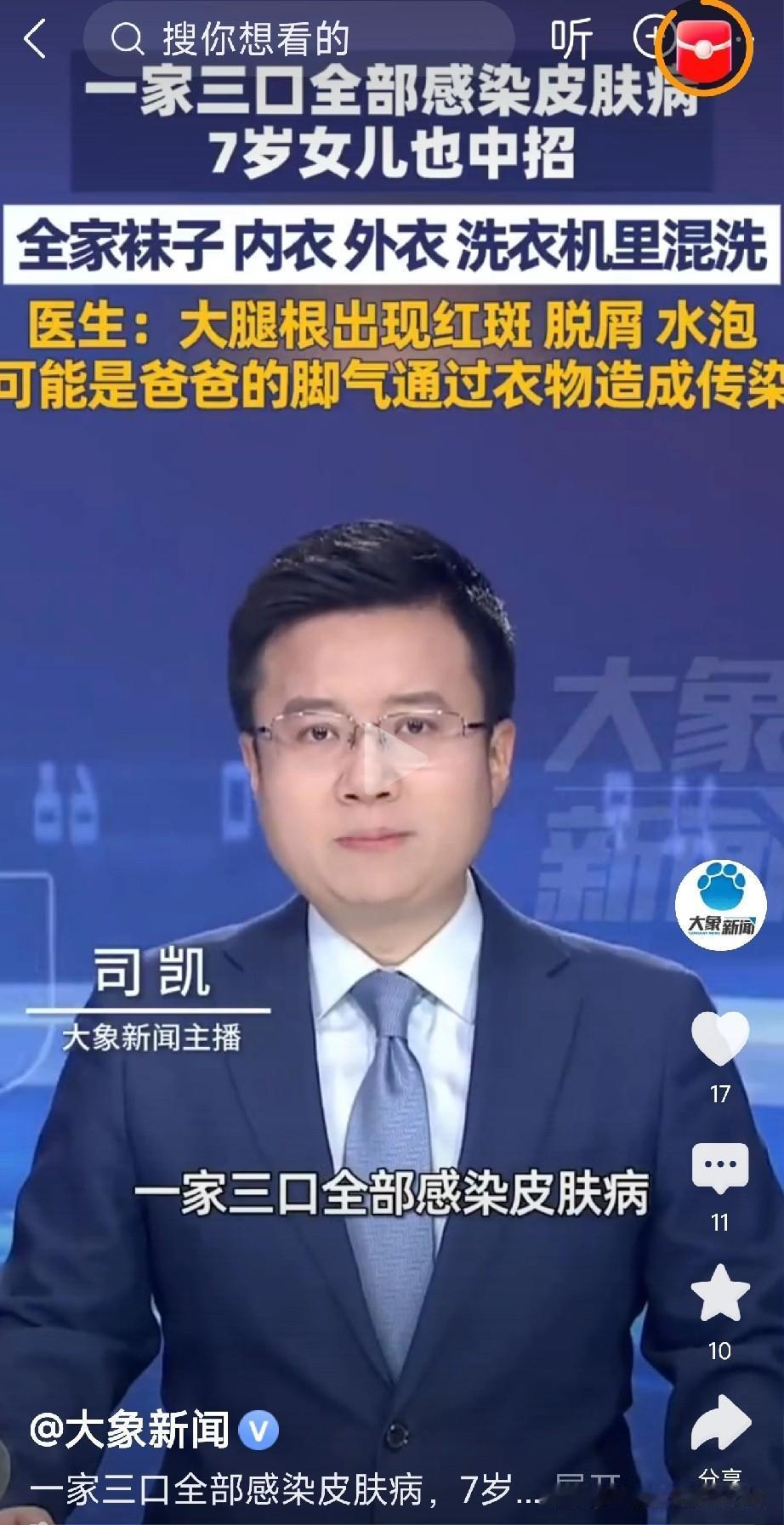 有混洗衣物习惯的人注意了

河南郑州一家三口身上全冒红疹，大腿根还出现红斑、脱屑