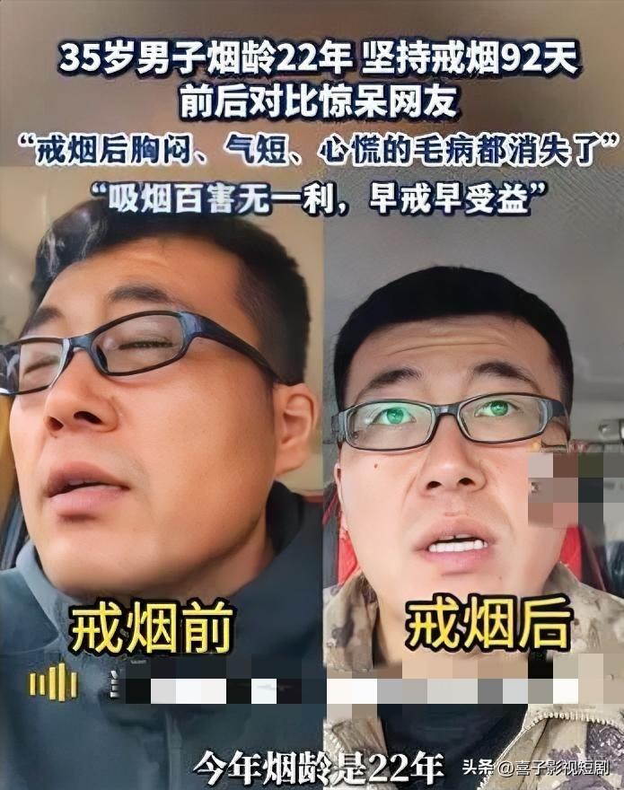 22年烟龄男子戒烟92天，重获新生

小张有着22年烟龄，每天至少一包烟，牙齿被