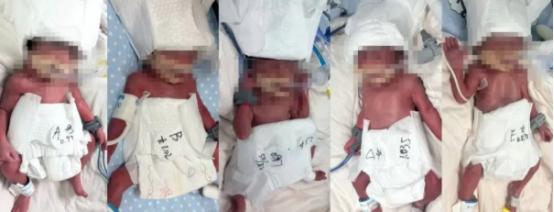 一觉醒来，被人民日报的消息震撼到了。24岁的新疆女子迪丽，在武汉创下了六千万分之