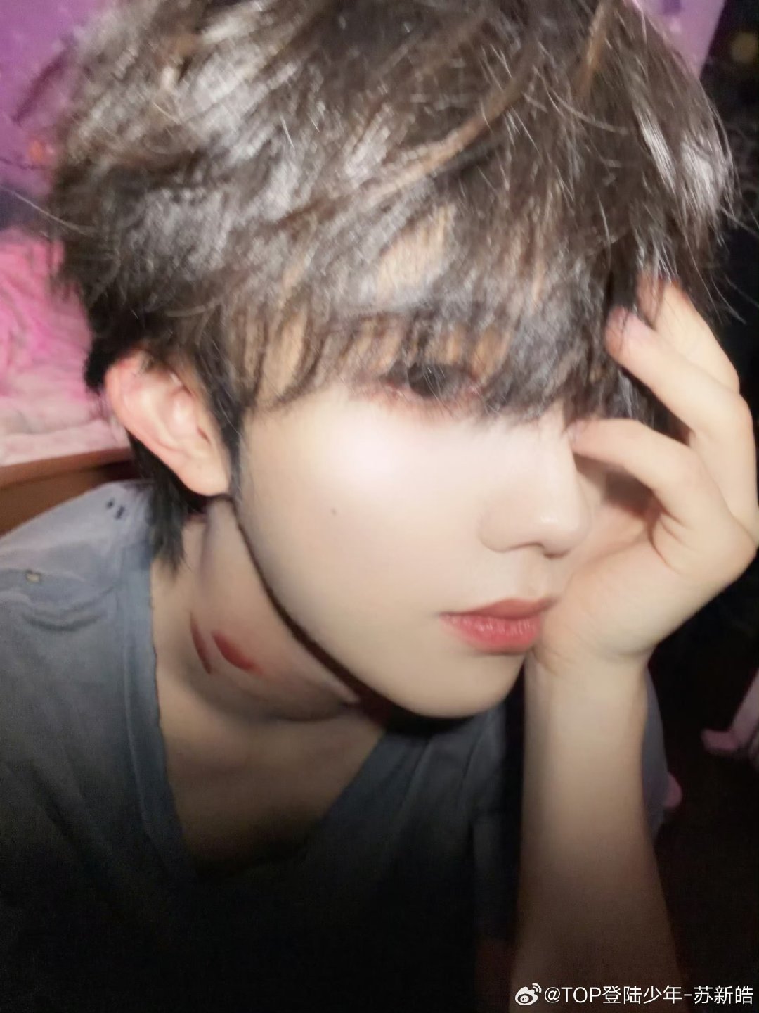 苏新皓苏新皓吻痕自拍照 嘿嘿，小孩长大了