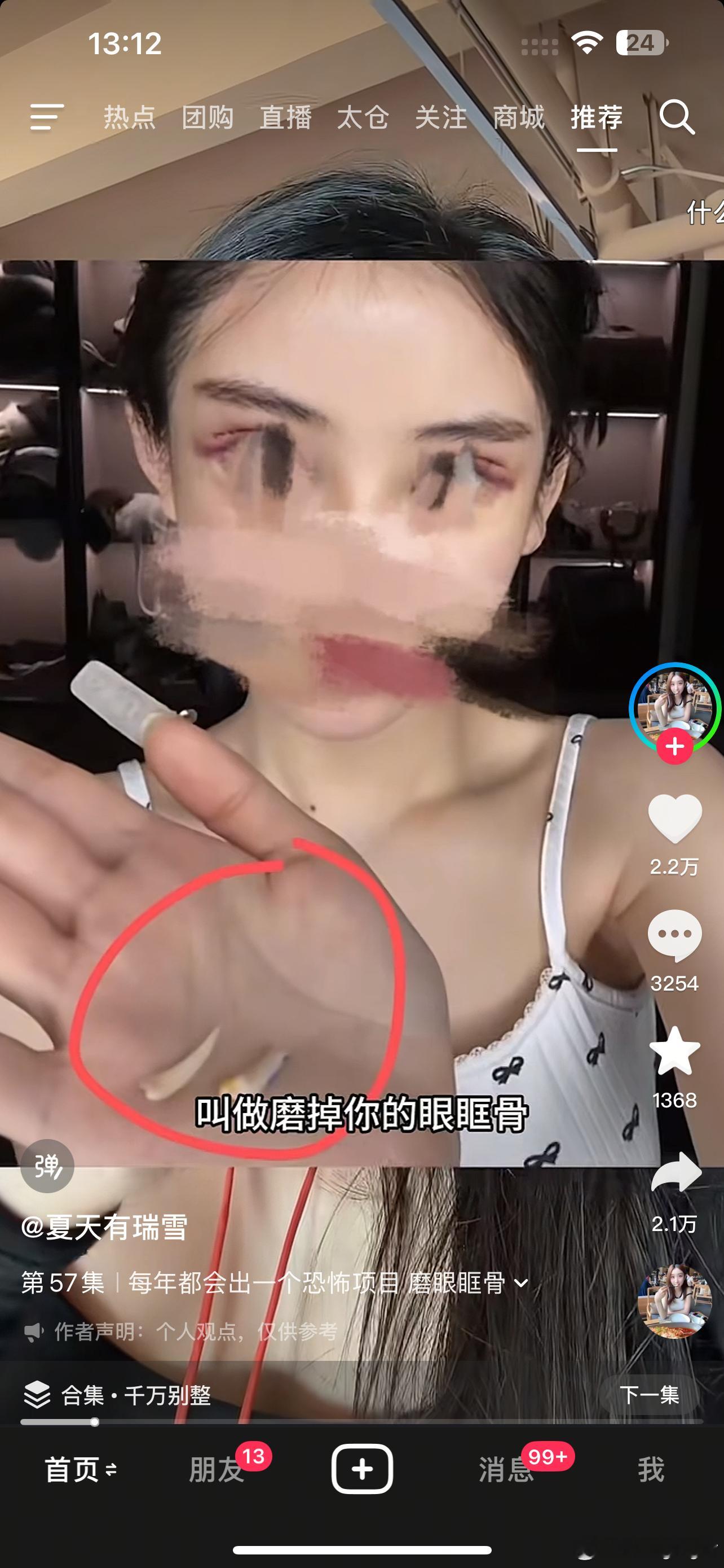 卧槽吓晕 