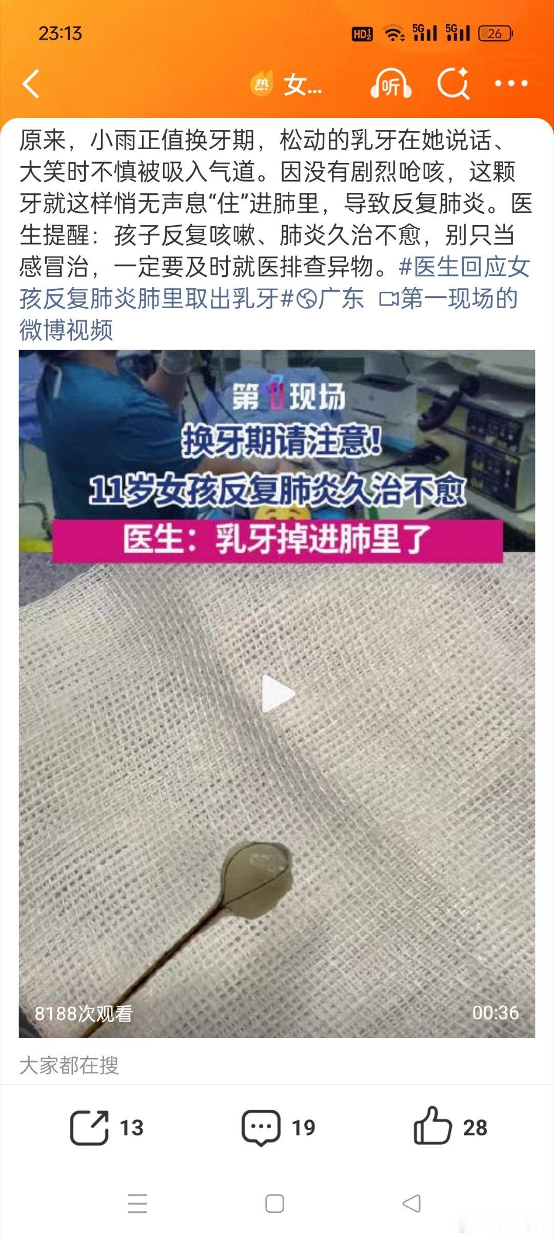 女孩咳了一个月肺里竟取出1颗牙这也太吓人了，这个事例再一次提醒家里有半大不小的孩
