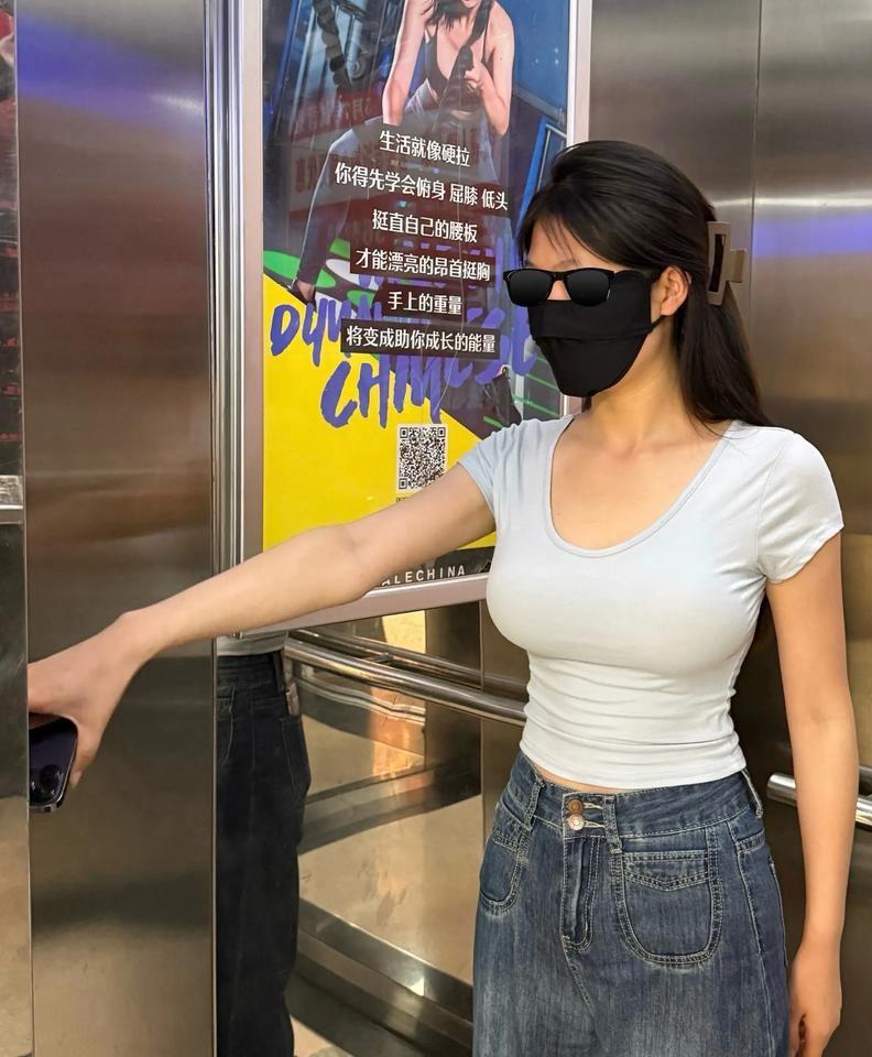 深圳26岁女子李李在公司体检中查出染色体46,XY，确诊完全性雄激素不敏感综合征