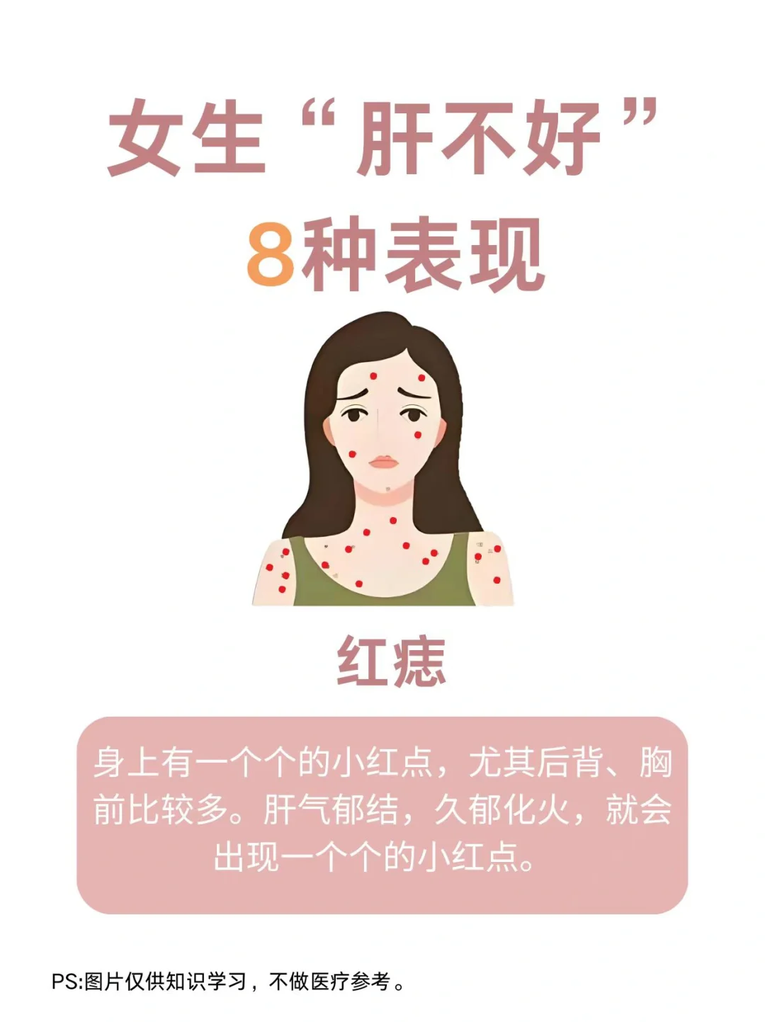 医学生笔记——肝不好的表现