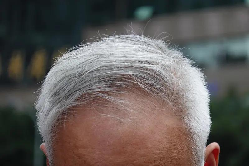 到了五十岁，才深刻体会到岁月这把杀猪刀的威力。以前总觉得白发增多不算啥，可现在出