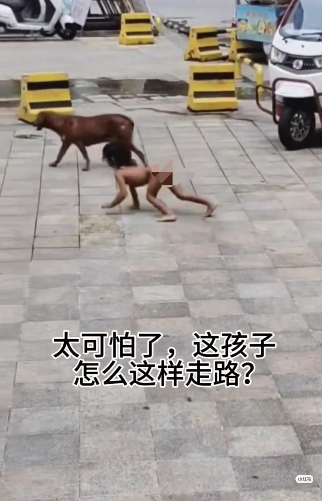 可怜的孩子，怎么才能救他？