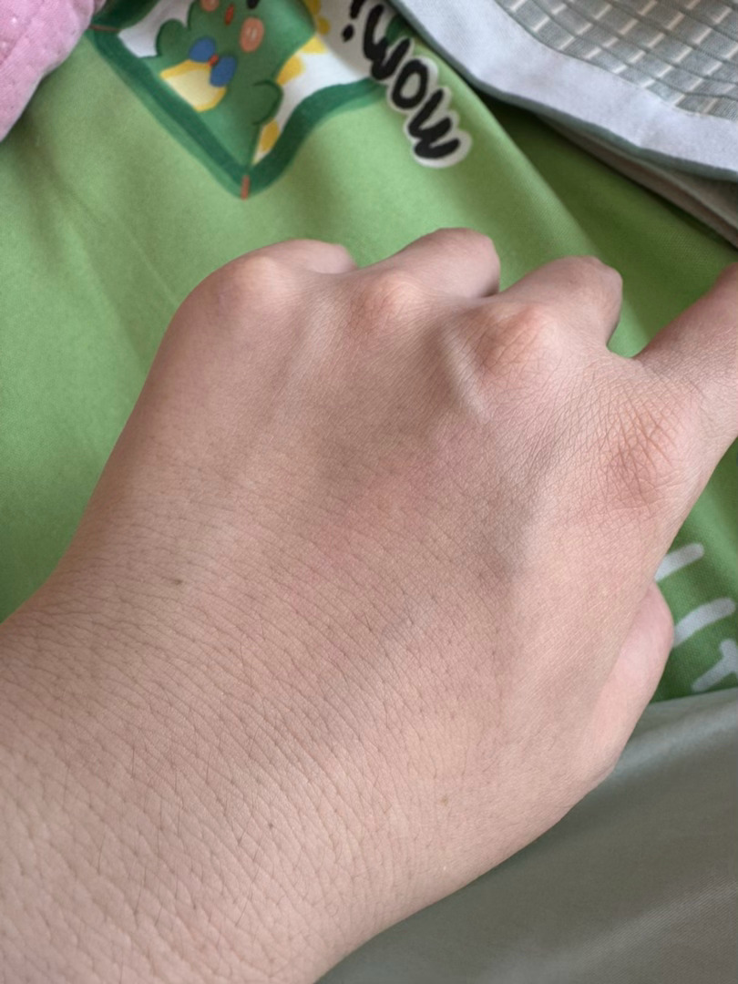每天都有诸多疑问为啥生了孩子以后手上青筋暴起了 