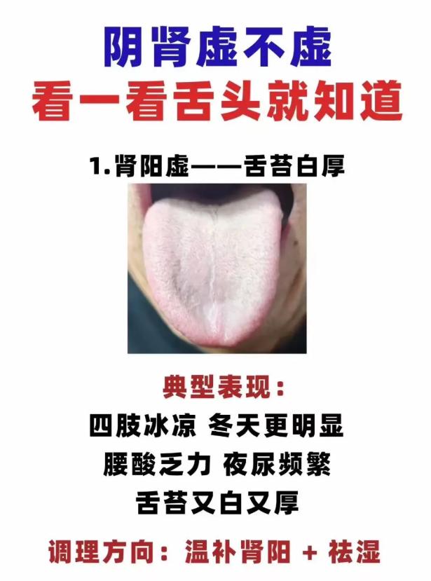 想知道肾气是否亏虚？看舌象就能初步判断