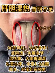 整理了四个舌象案例，看看有没有这种情况
 
1、肝胆湿热，肾阴不足
2、命门火弱
