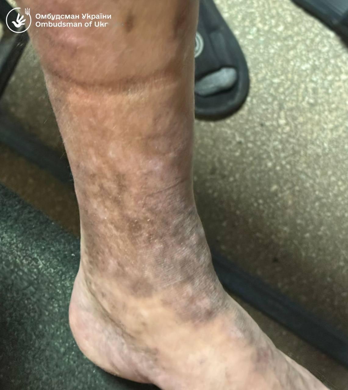 乌克兰自曝：揭露乌克兰征兵处存在违规行为
乌克兰监察专员德米特罗·卢比涅茨在对乌