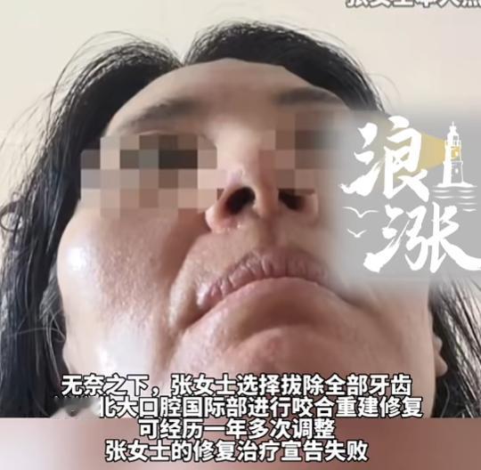 “太惨了！”7月5日，北京，一女子因为缺牙，去2家医院做正畸手术，却接连遭遇诊疗