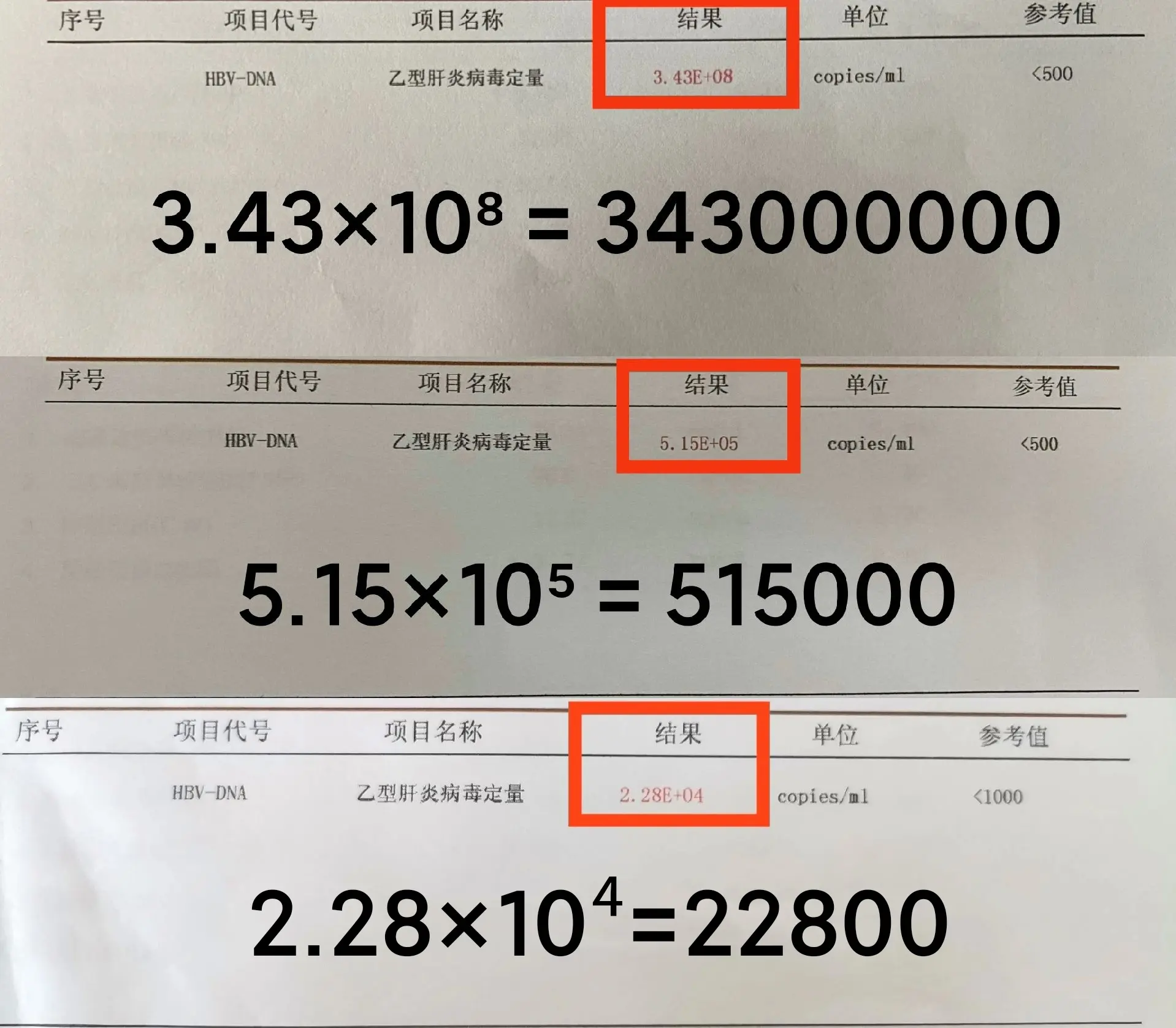 乙肝病毒多少的时候需要抗病毒？ 以前我们治病会谈论病毒载量的高低，现在...