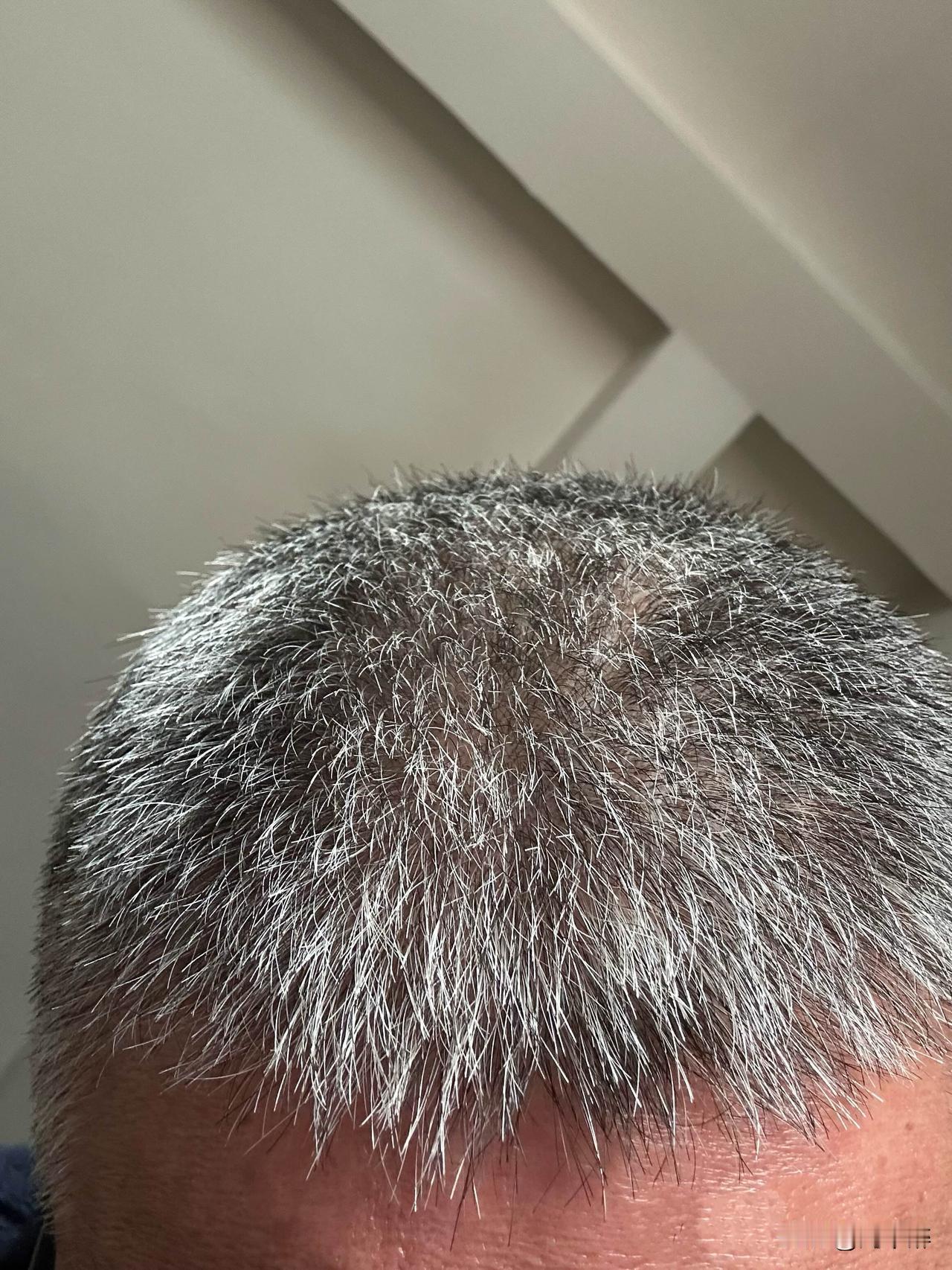 退休了，从现在起不再染发啦！
染发看似能让人显得年轻，实则不过是自欺欺人罢了！关