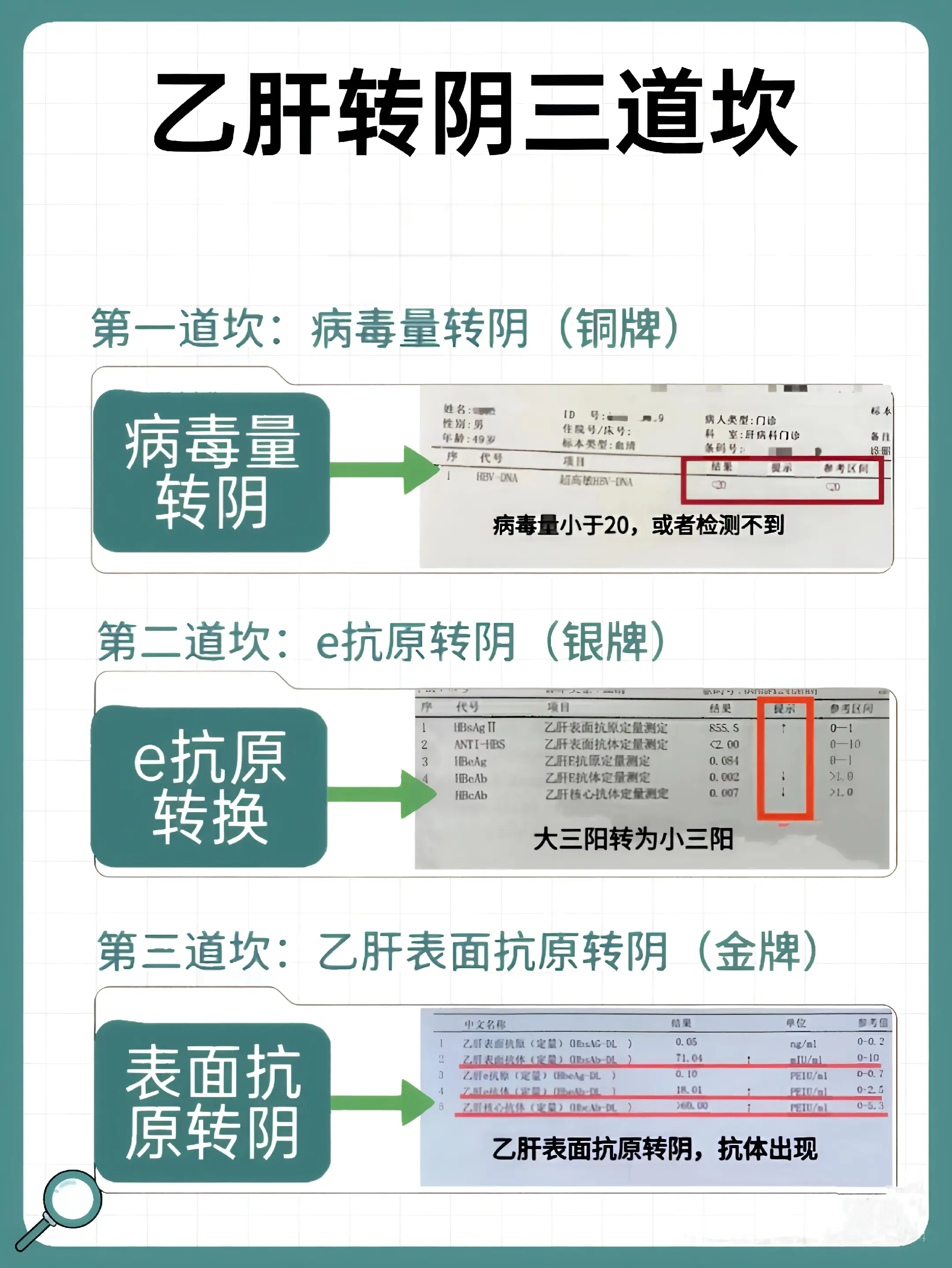 乙肝转阴三道坎！