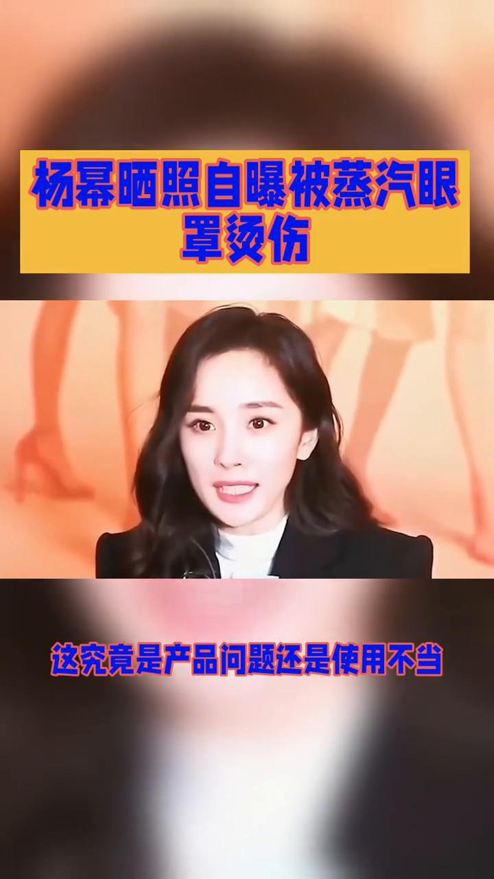 杨幂晒照自曝被蒸汽眼罩烫伤。
杨幂晒照自曝被蒸汽眼罩烫伤，这究竟是产品问题还是使