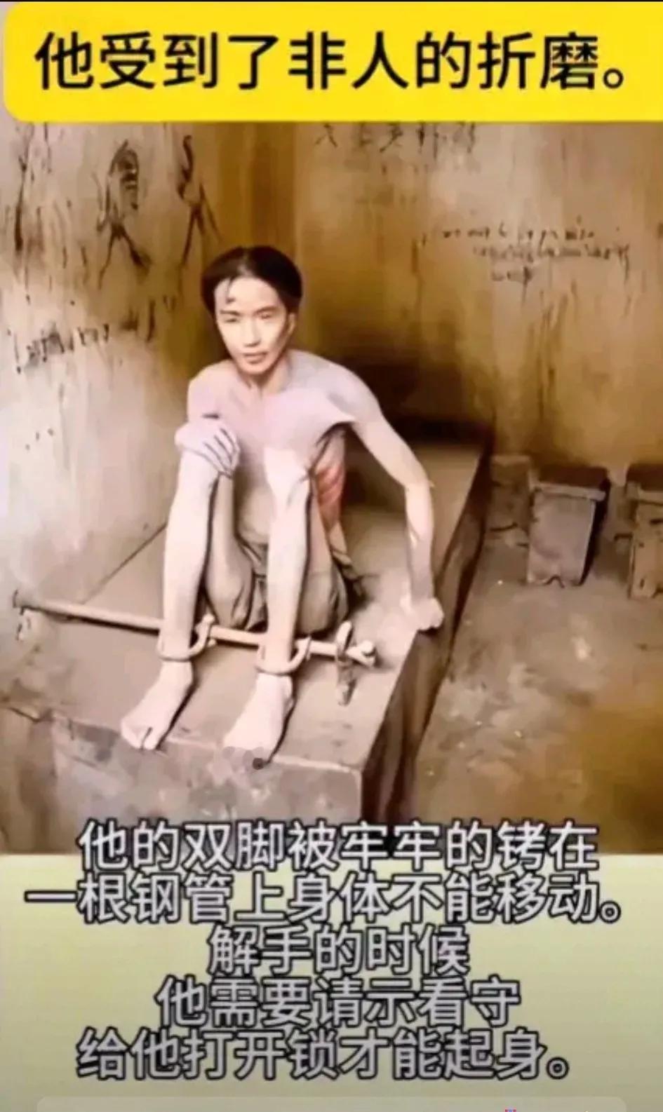 看照片的这位男人，瘦骨嶙峋，骨瘦如柴，奄奄一息，好像随时咽气的样子令人痛心不已，