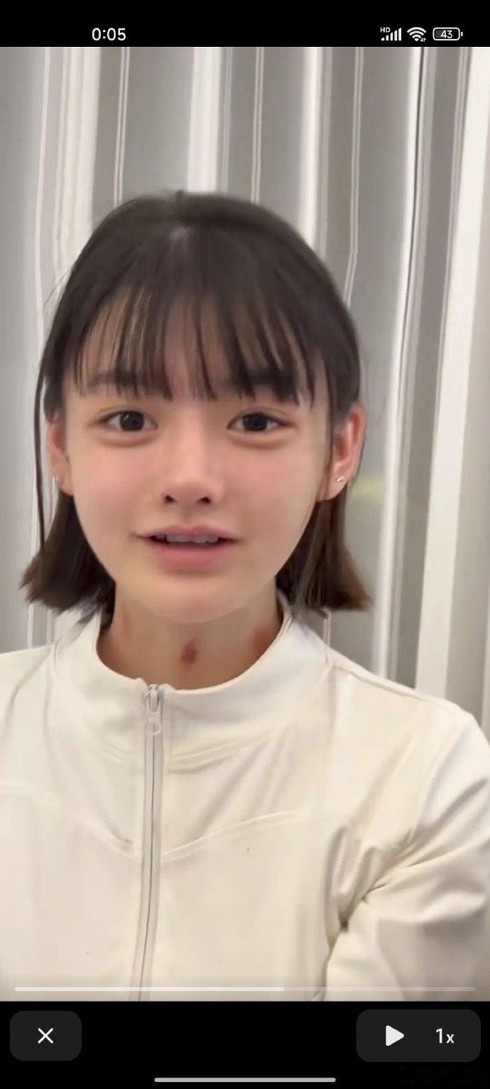 被幼态脸审美吓到！这还是正常人吗？左边这位网红超火，脸和身子颜色差异大，这脸到底