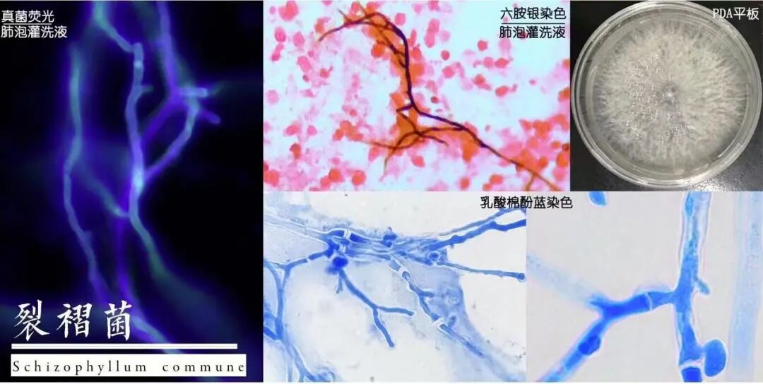 一家人同时发热、咳嗽，撬开家里地板震惊了，医生提醒