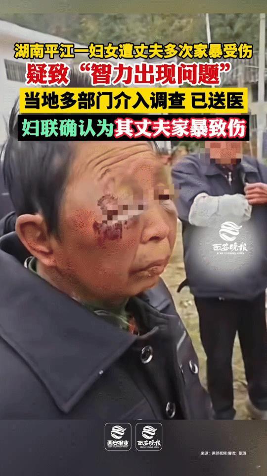 湖南平江一妇女遭家暴疑似智力受影响，这事看得人揪心！
 
湖南平江一妇女被丈夫多