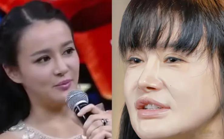 冉莹颖现在的脸和10年前判若两人，嘴巴都大了 