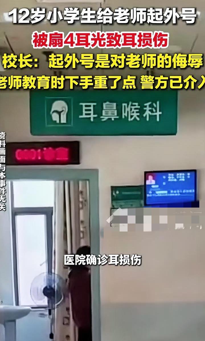 老师太冲动了，连扇学生四巴掌，只因一时气不过学生给自己起外号。
云南昭通一私立学