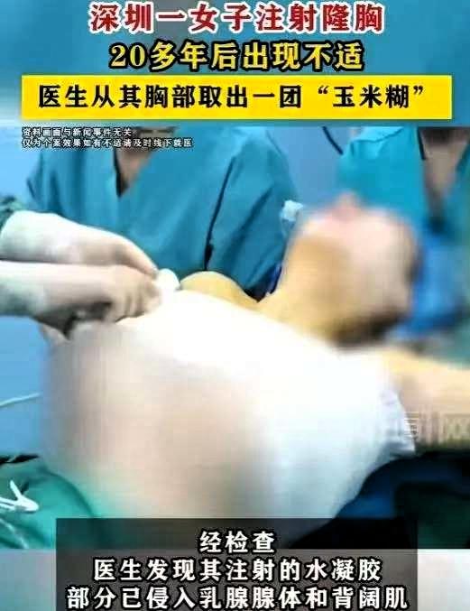 深圳王女士最近在前海泰康医院做了个胸部手术，主刀的是甲乳外科张明帅主任。原本以为