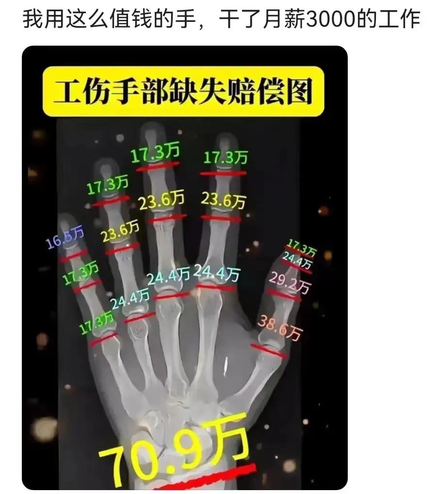 原来我的手那么值钱，用那么值钱的手工作的时候咋就换不来那么多钱了[泪奔]