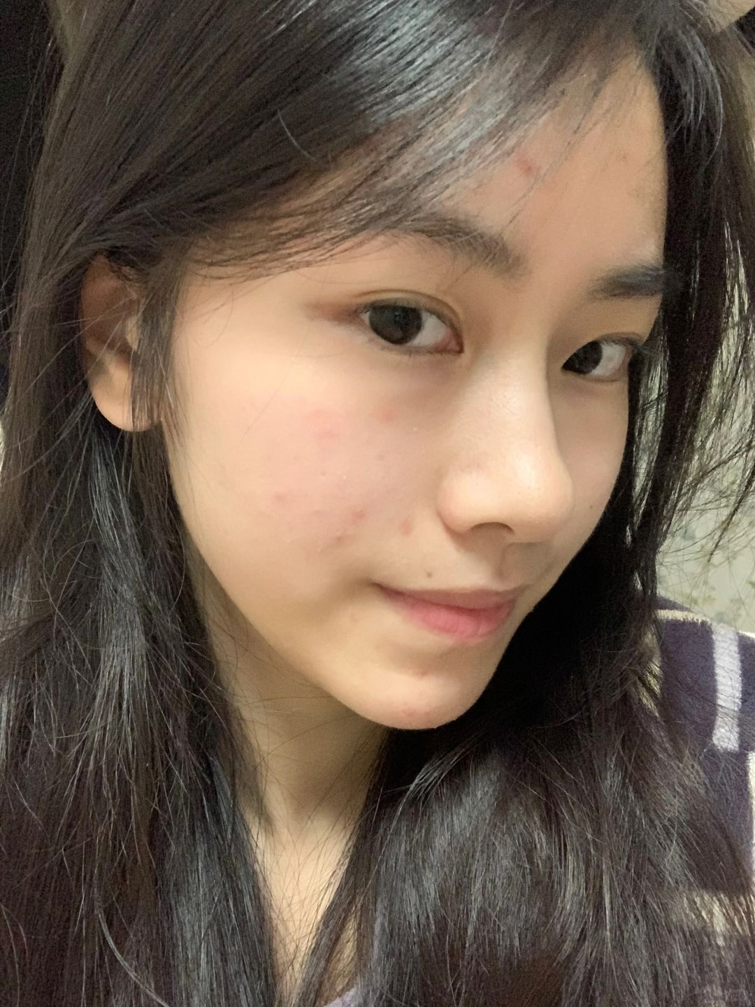 再也没长hong肿豆了😭原因被我找到了想哭‼️