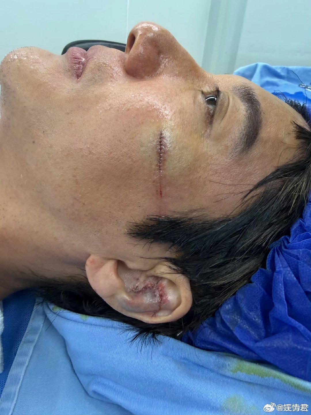 王力宏脚被钢丝卷到 王力宏摔倒原因及时处理了就好 