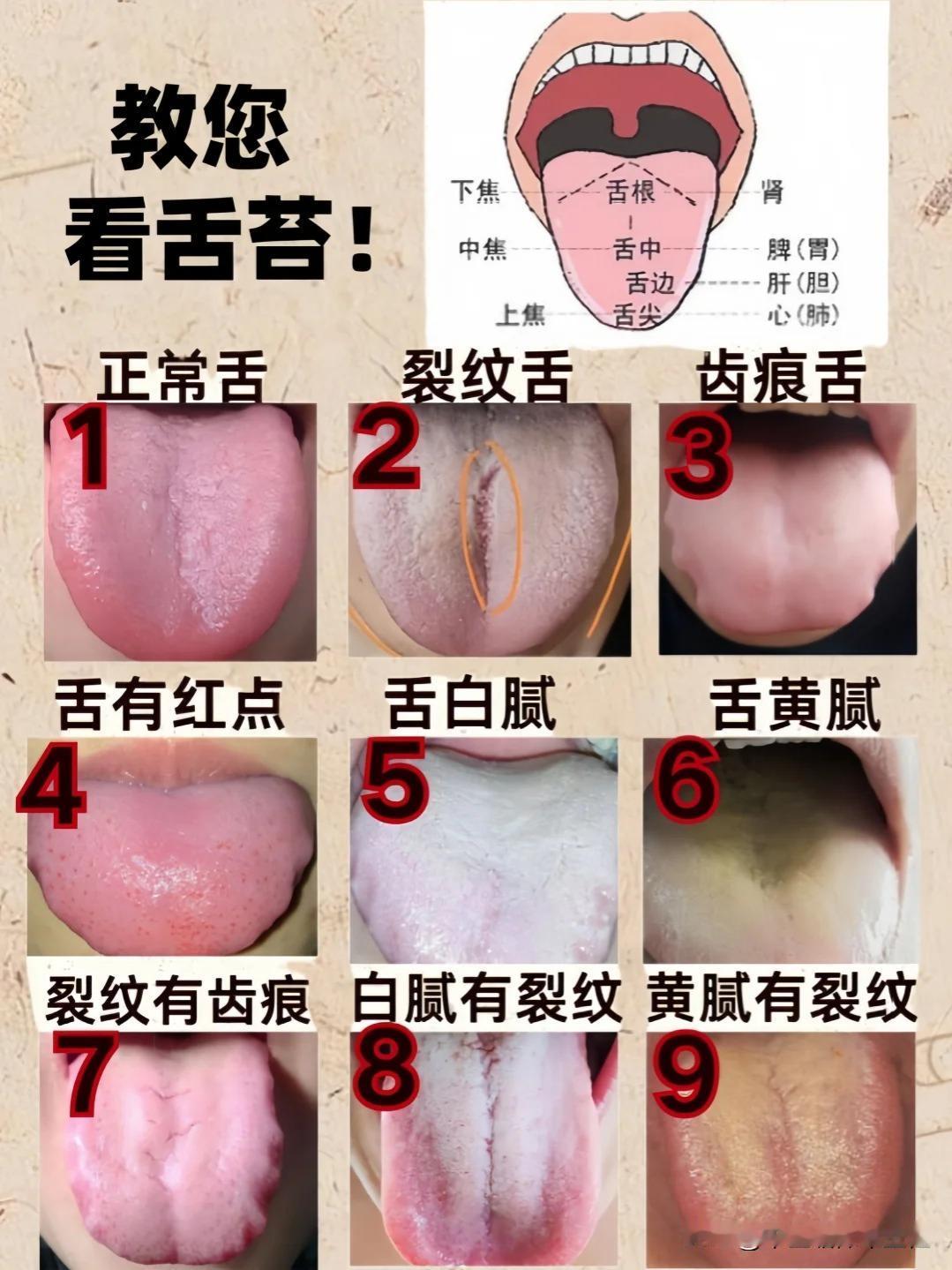 免费舌诊——只要你发，我就看，绝对不会少看一个人的！

防止还有人不知道拍舌头需