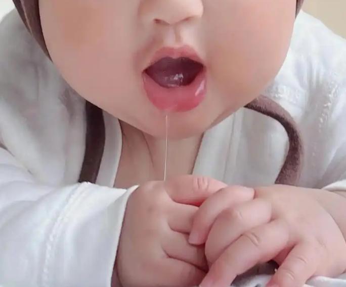 流口水是怎么回事？

小孩流口水是正常，因为脾常不足，什么叫脾常不足？意思就是小