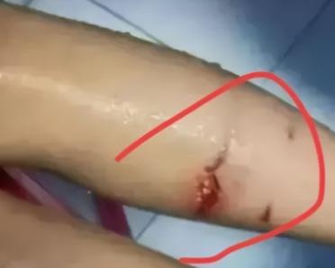 沈阳，男子下班路上被大狗袭击，情急之下，用刀砍死大狗才脱困。住院一周后狗主人不但